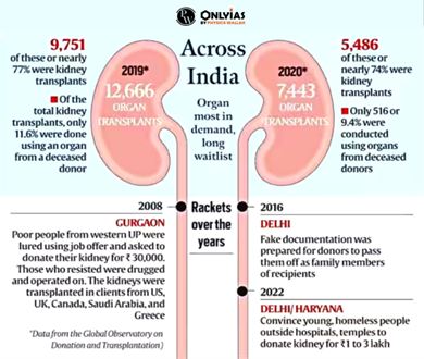 Kidney