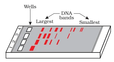 typical agarose gel electrophoresis 