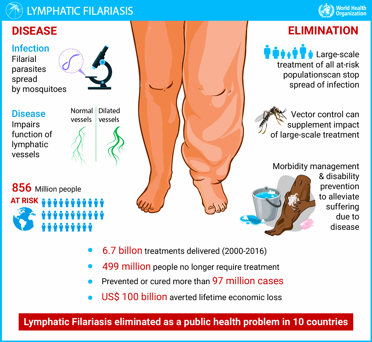 Lymphatic Filariasis