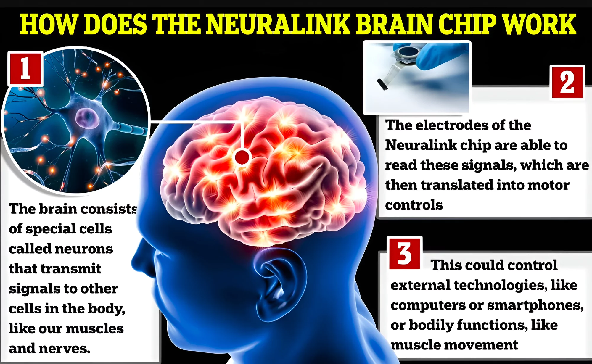 Neuralink 