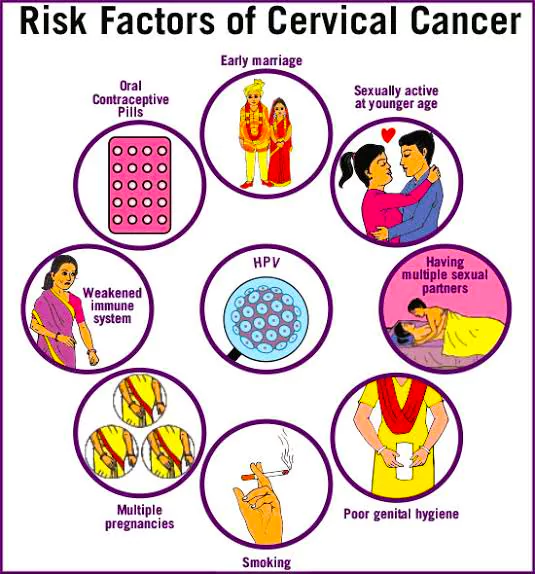 Cervical Cancer