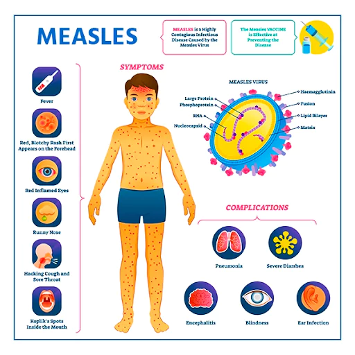 Measles and Rubella Champion Award