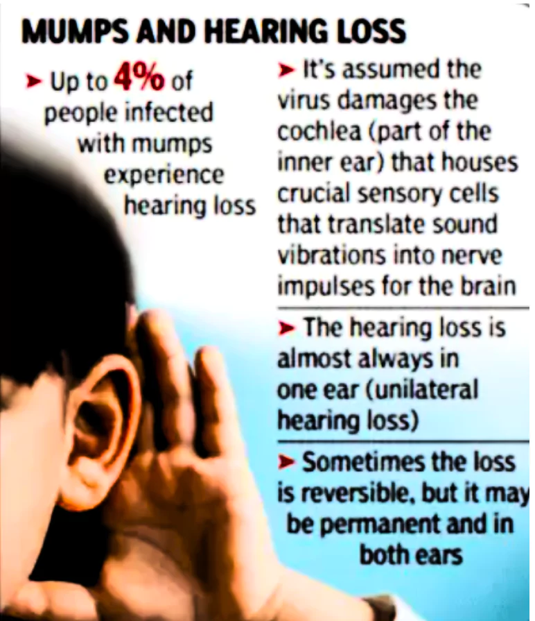 Mumps Outbreak in Kerala
