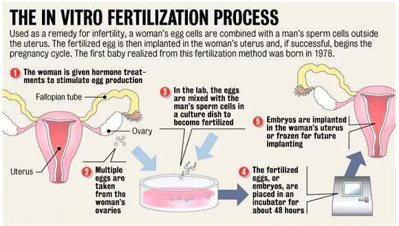 IVF Treatment