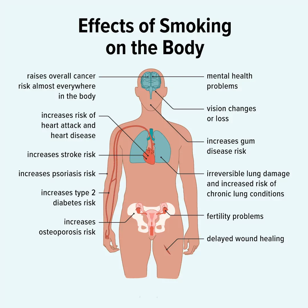 Hookah Ban in Karnataka