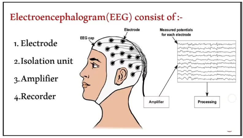 Electroencephalography 