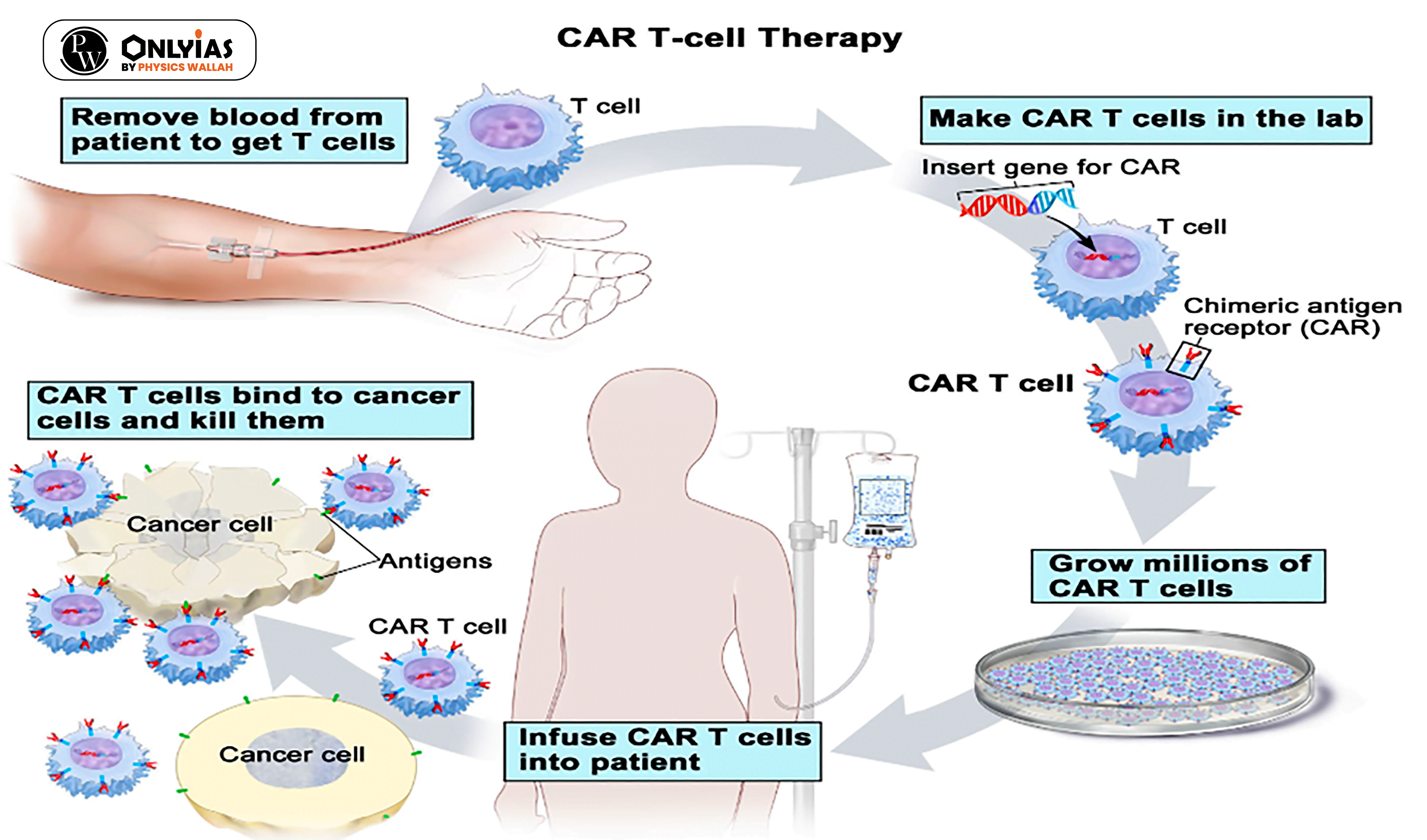 CAR T Cell therapy