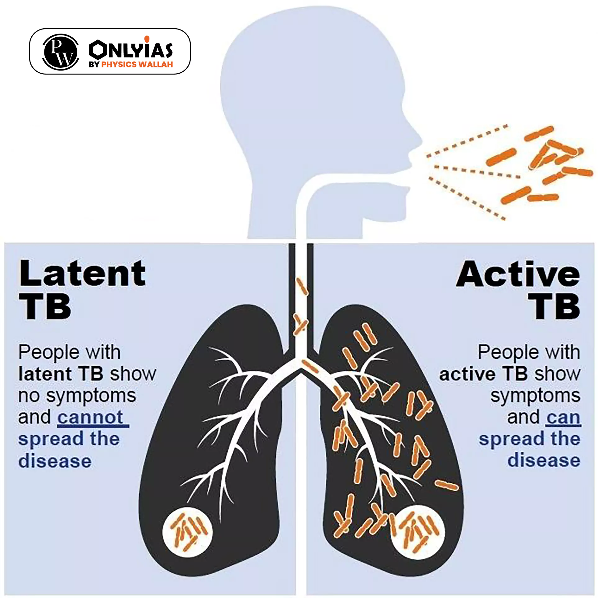 eliminate TB