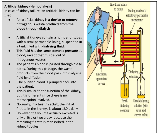 Artificial kidney (Hemodialysis)
