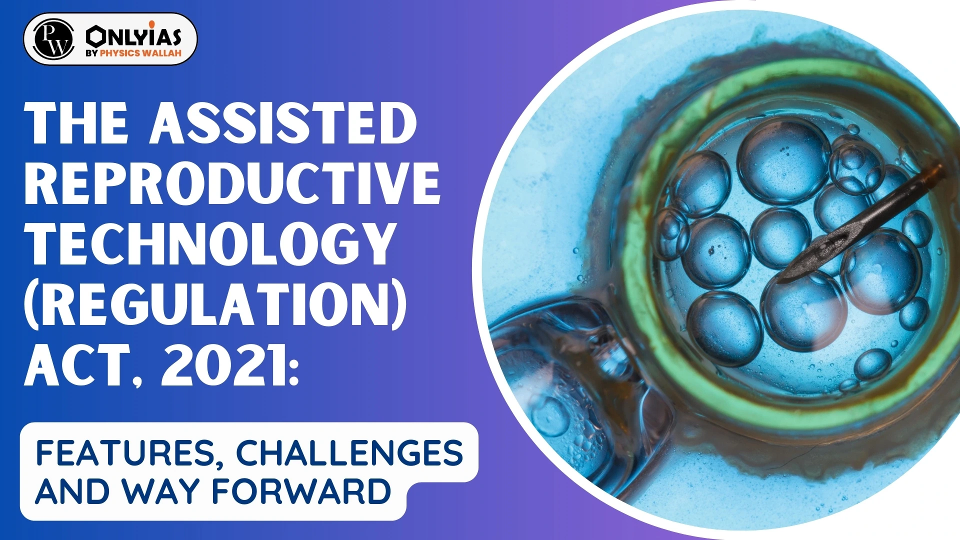 The Assisted Reproductive Technology Regulation Act 2021 Features Challenges And Way 9016