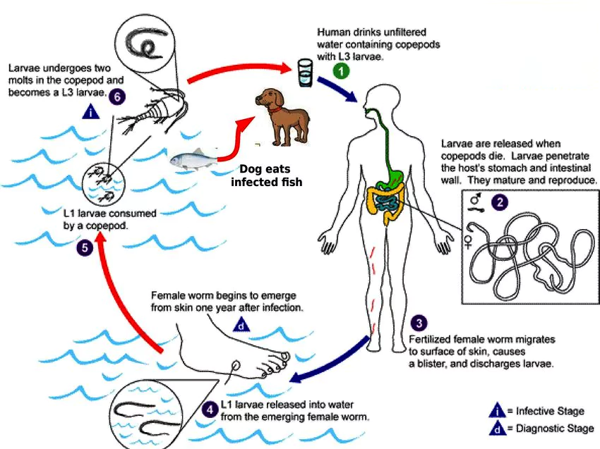 Guinea Worm Disease (Dracunculiasis): Cause, Symptoms, Transmission ...