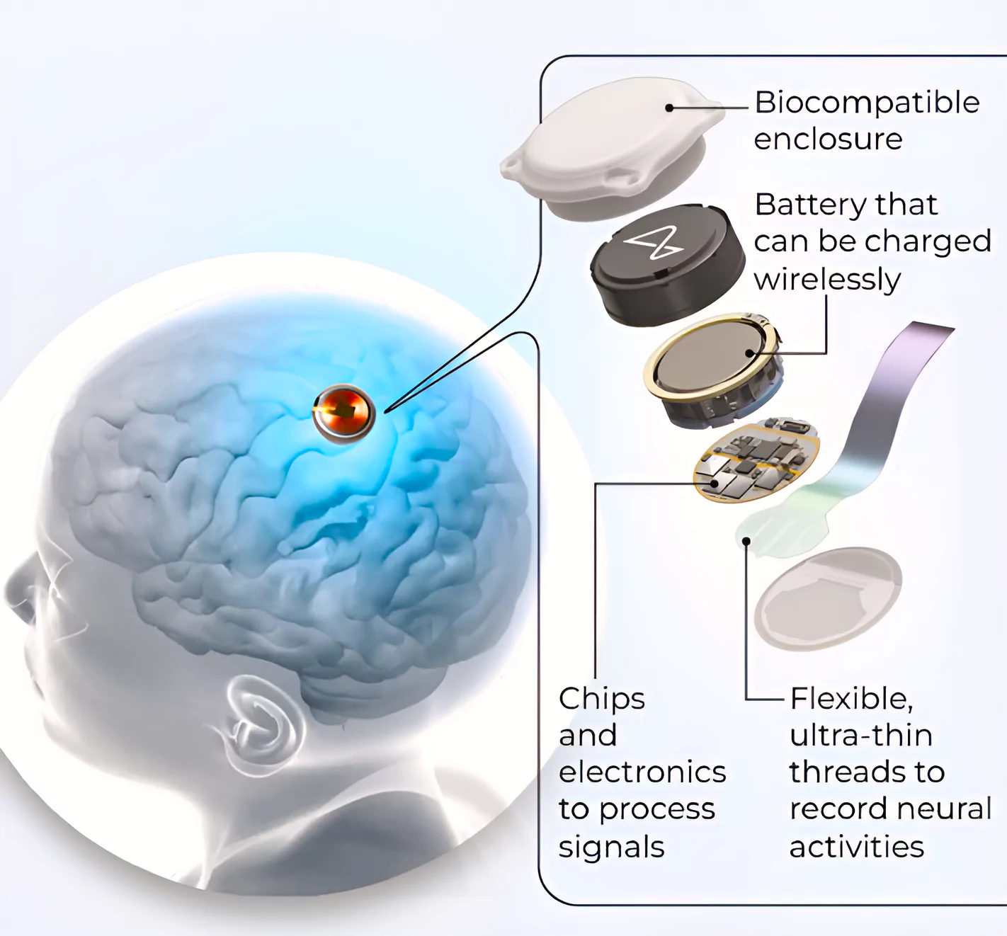 Neuralink 