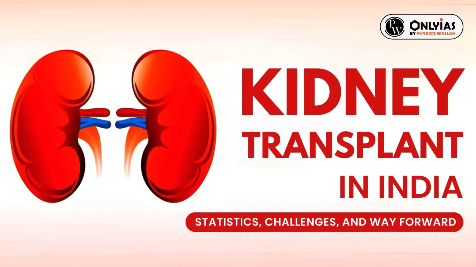 Kidney Transplant in India: Statistics, Challenges, and Way Forward
