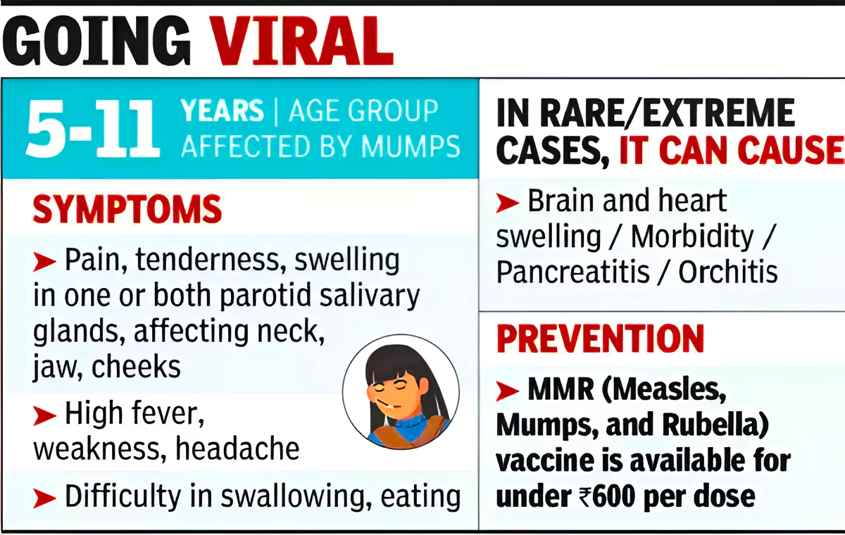 Mumps Outbreak in Kerala
