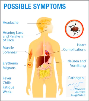 Lyme Disease