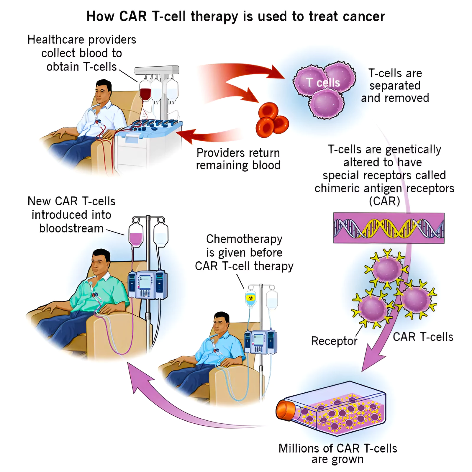 CAR-T cell therapy
