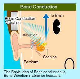 Piezoelectric bone conduction hearing implant