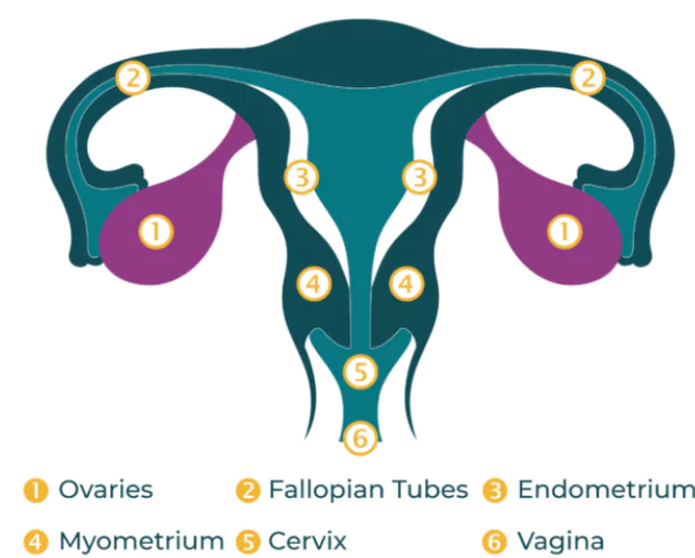 Ovarian Cancer