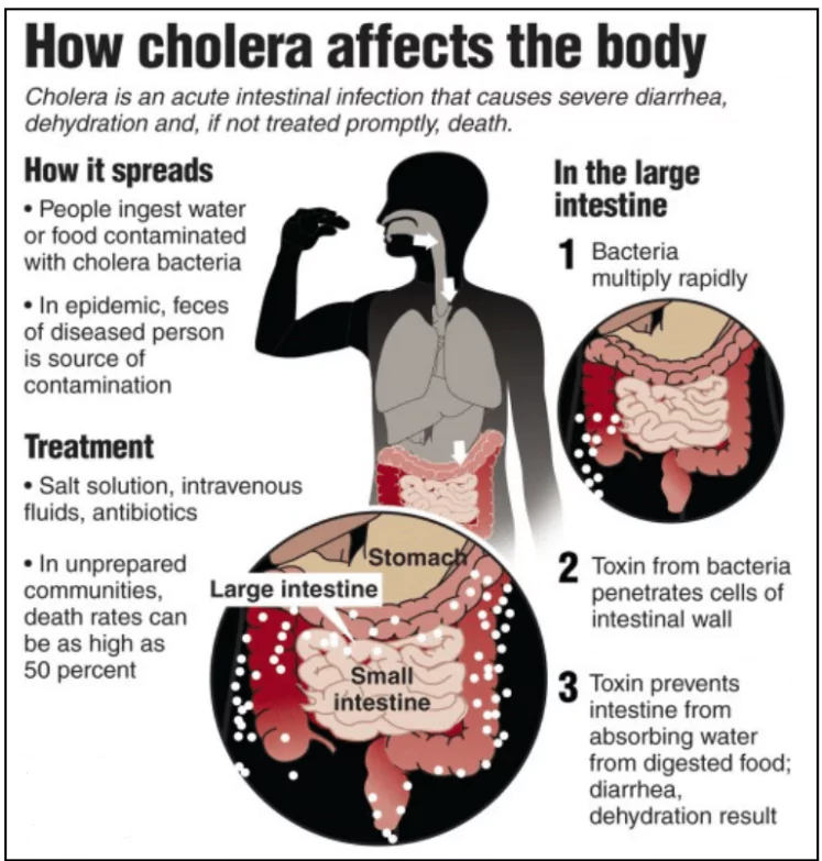 Cholera