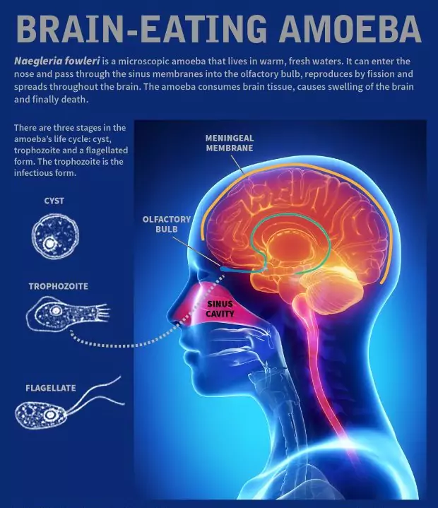 Amoebic meningoencephalitis