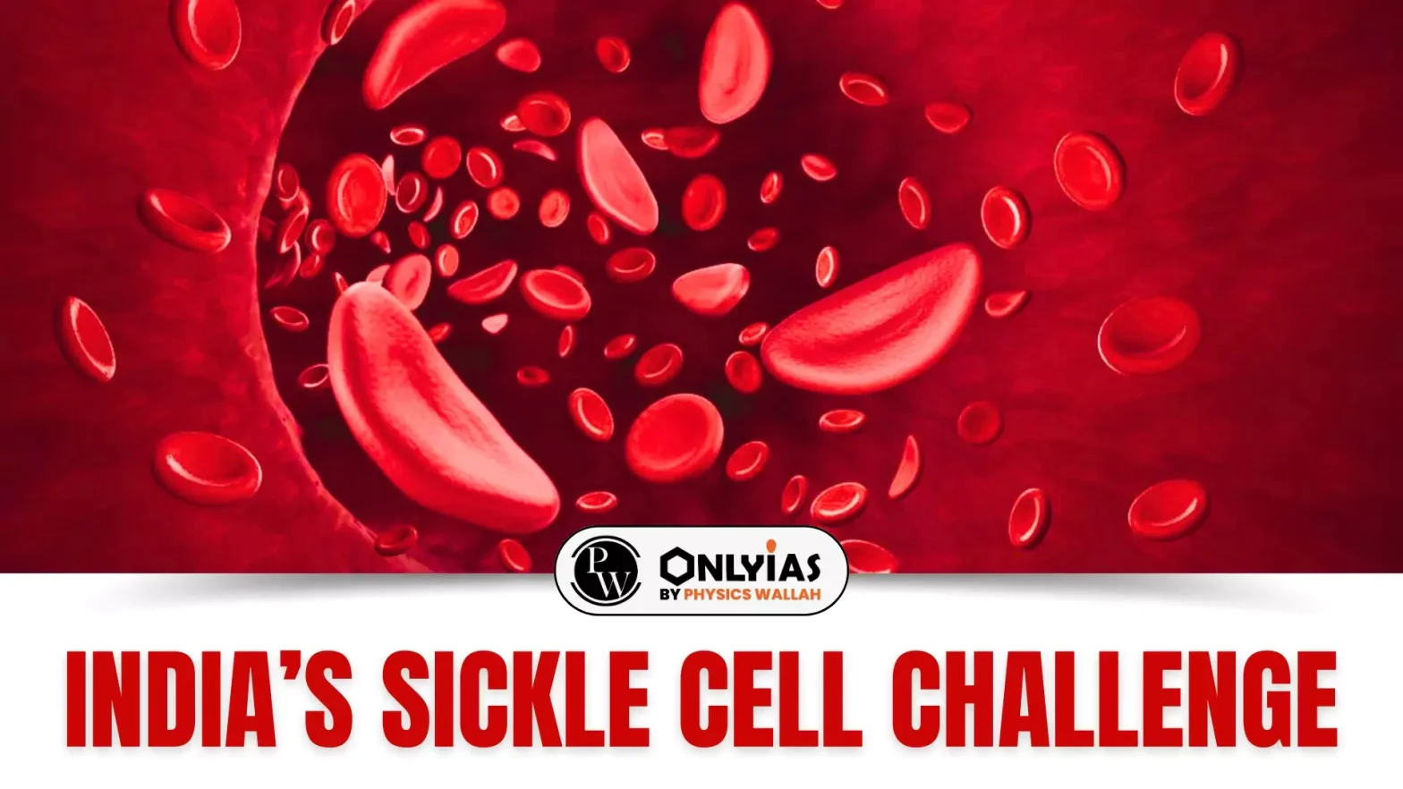 India’s sickle cell disease challenge