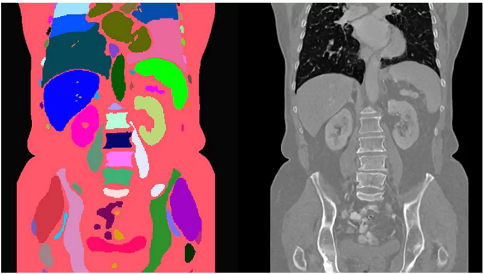 Synthetic Medical Images