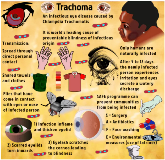 Trachoma