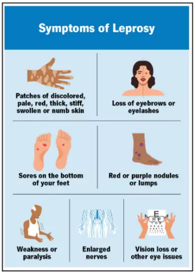Leprosy