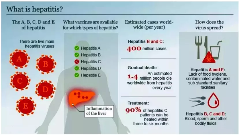 Hepatitis A