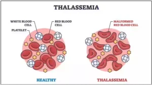 National Blood Transfusion Bill
