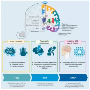 Deep Brain Stimulation Workshop
