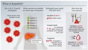 Hepatitis B