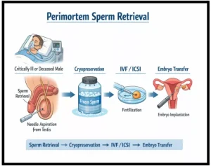 Perimortem Sperm Retrieval