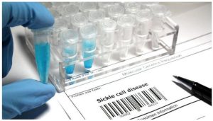 Sickle Cell